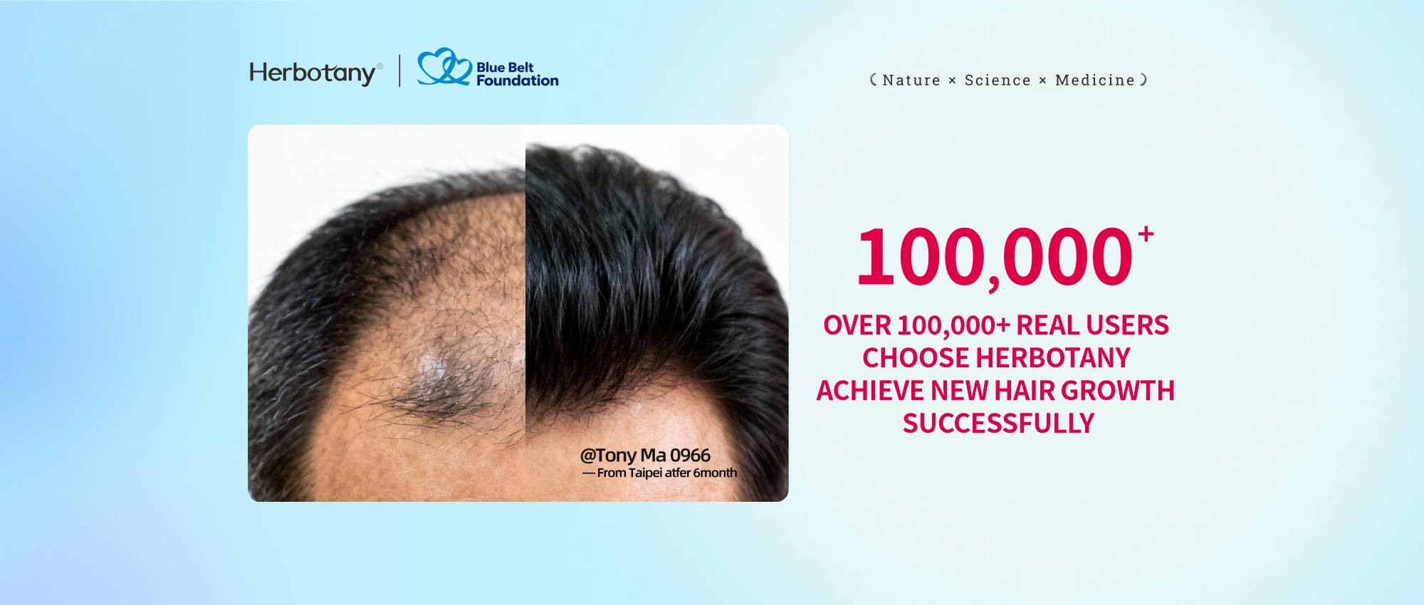 生发产品轮播图7